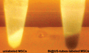 Image: An X-ray image of unlabeled mesenchymal stem cells in test tubes shows the dramatic difference between those tagged with nanotubes that don't include bismuth (left) and those that do (right). The technique developed at Rice University shows promise for tracking live stem cells in the body (Photo courtesy of Eladio Rivera, Rice University).